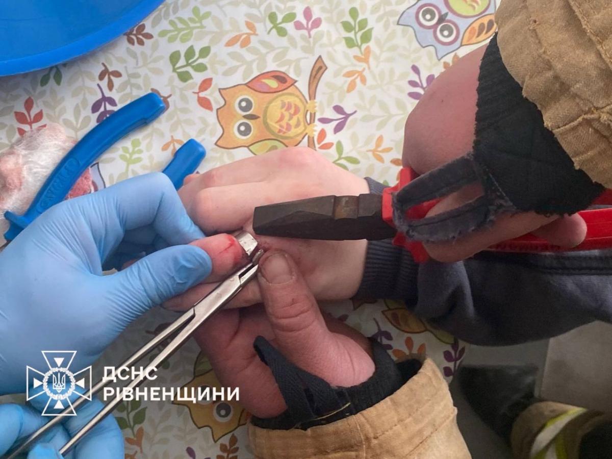 У Рівному рятувальники допомогли підлітку зняти застрягле кільце