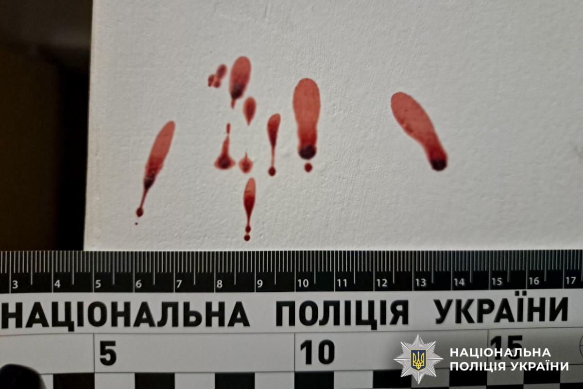 У Рівному чоловіка засудили до 5 років за ножове поранення сусіда