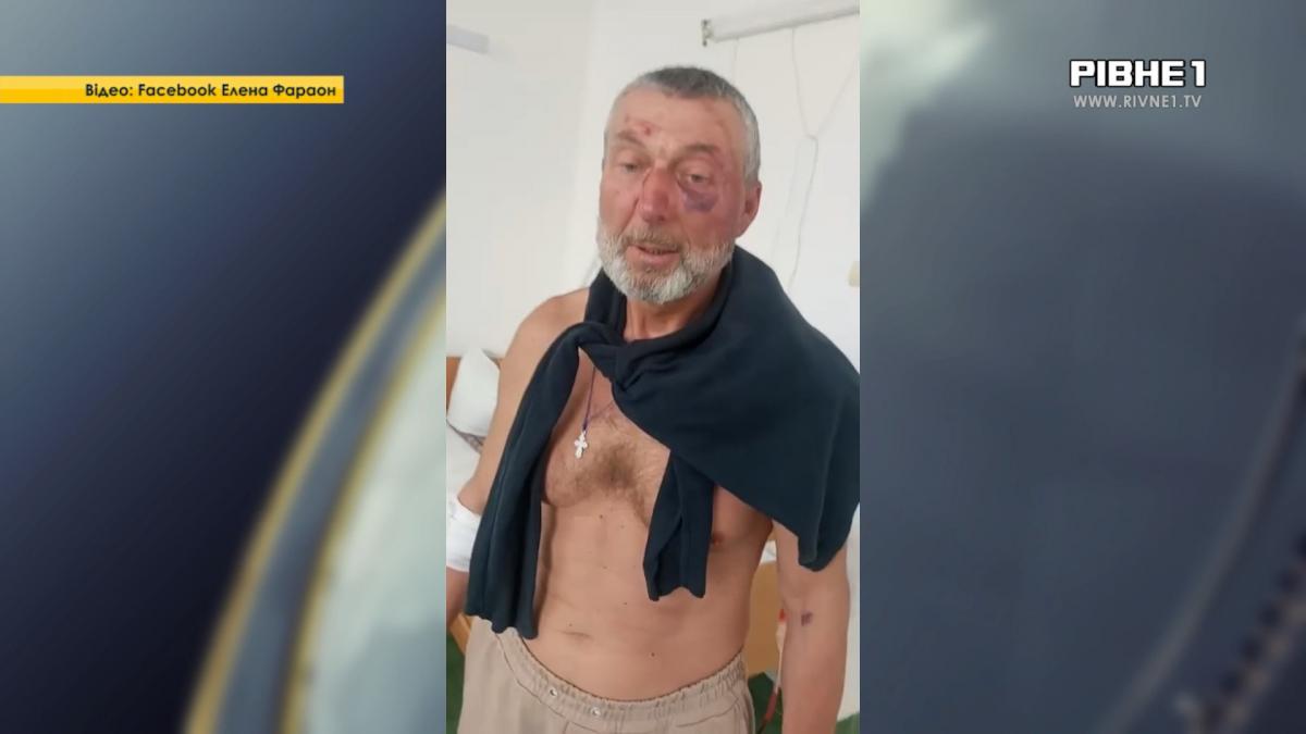 Що відомо про побиття ветерана від працівників ТЦК на Рівненщині (ВІДЕО)
