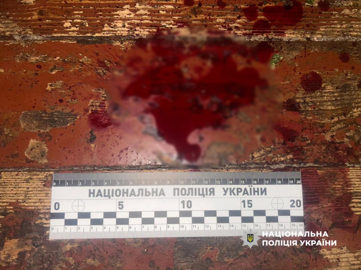 У Рівному чоловік ударив сусіда ножем у шию: нападнику повідомили про підозру