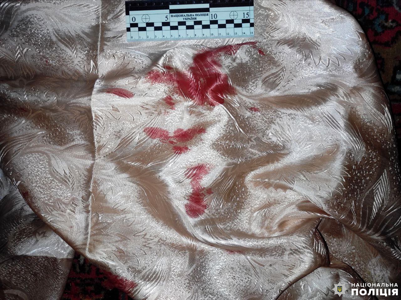 Під час сварки син побив матір: поліцейські затримали жителя Рівненського району