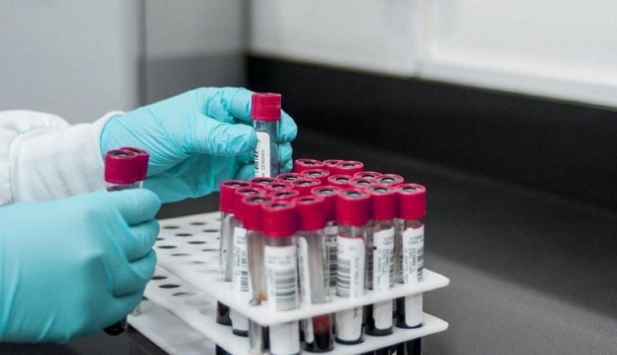 Фото ілюстративне