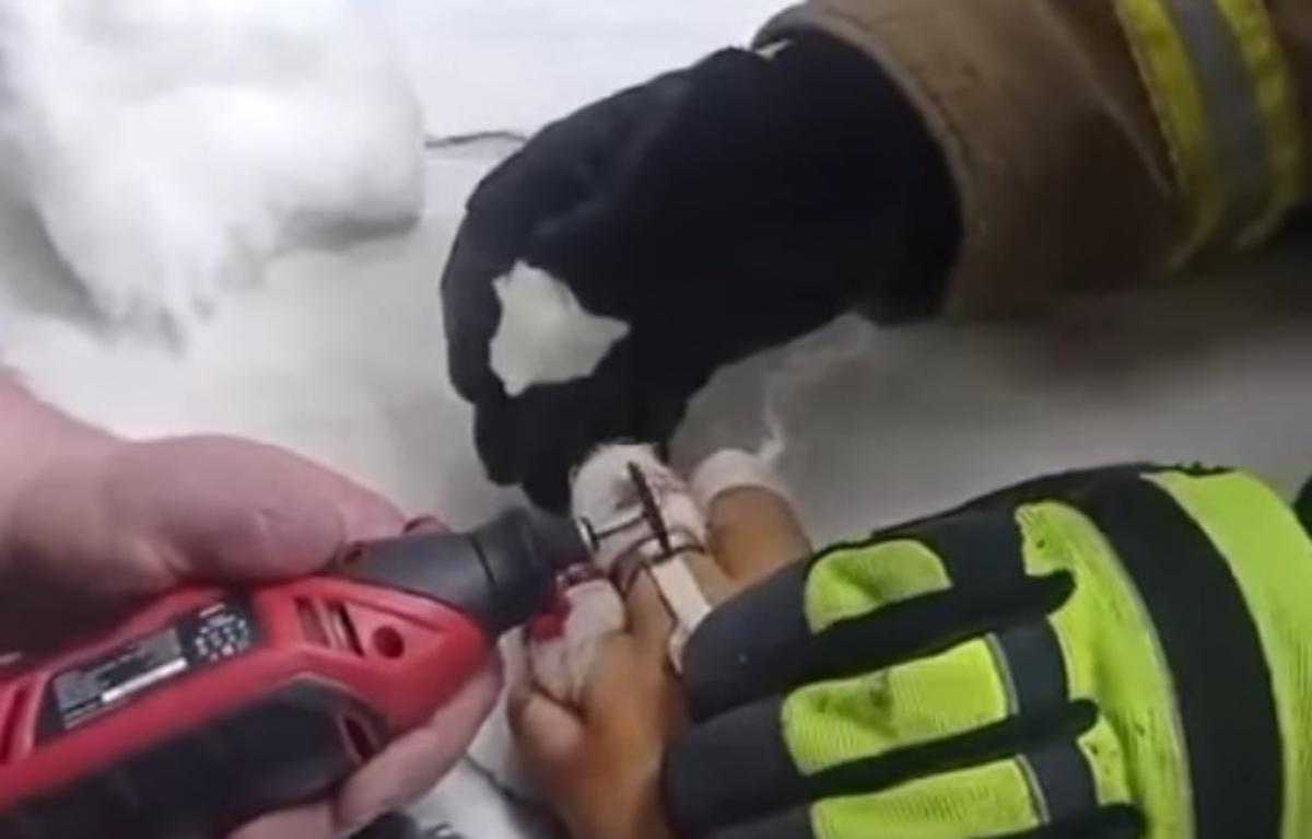 На Дубенщині рятувальники вивільнили палець підлітка з металевого кільця