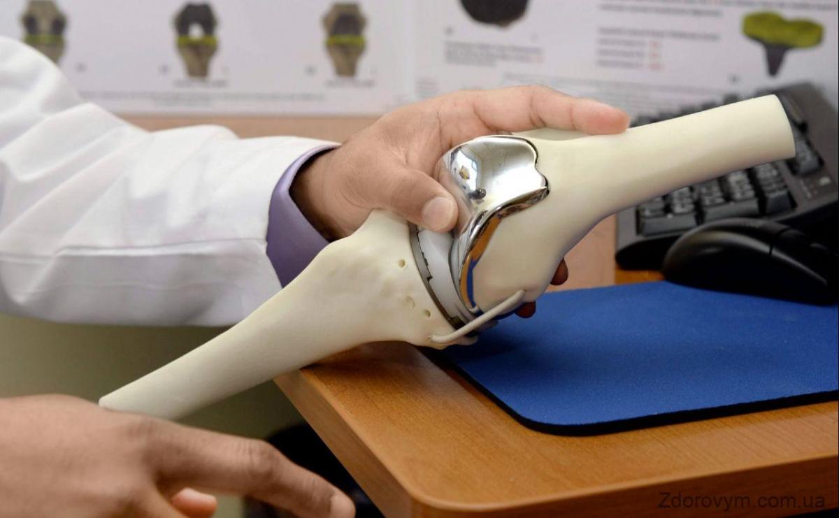 Фото ілюстративне