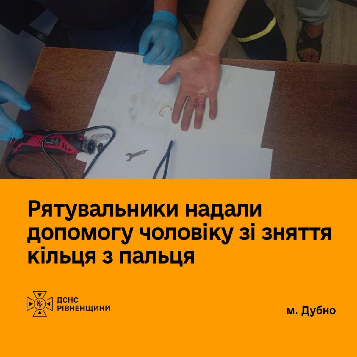 У Дубні чоловік звернувся до рятувальників через кільце, яке не міг зняти